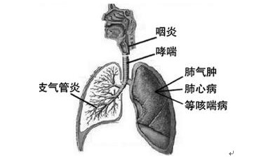 最新气管炎治疗方法的研究与应用进展